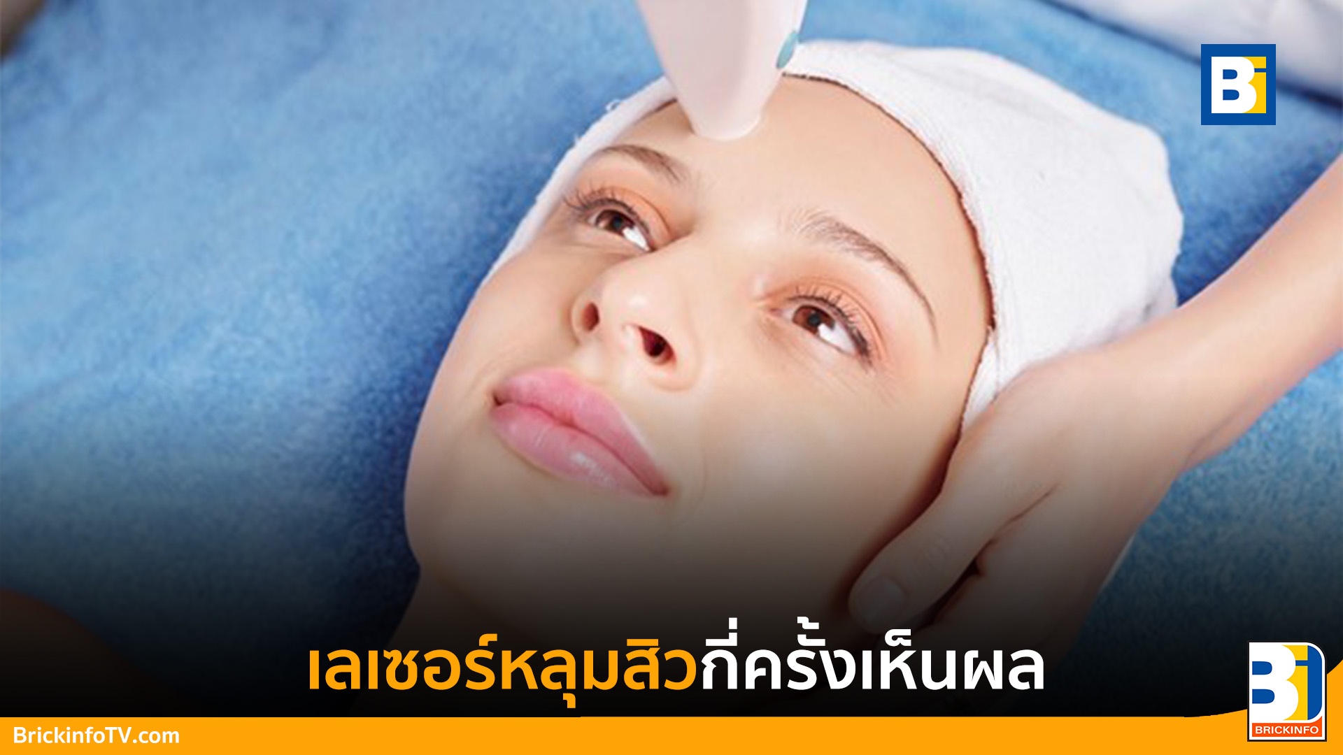 เลเซอร์หลุมสิวกี่ครั้งเห็นผล