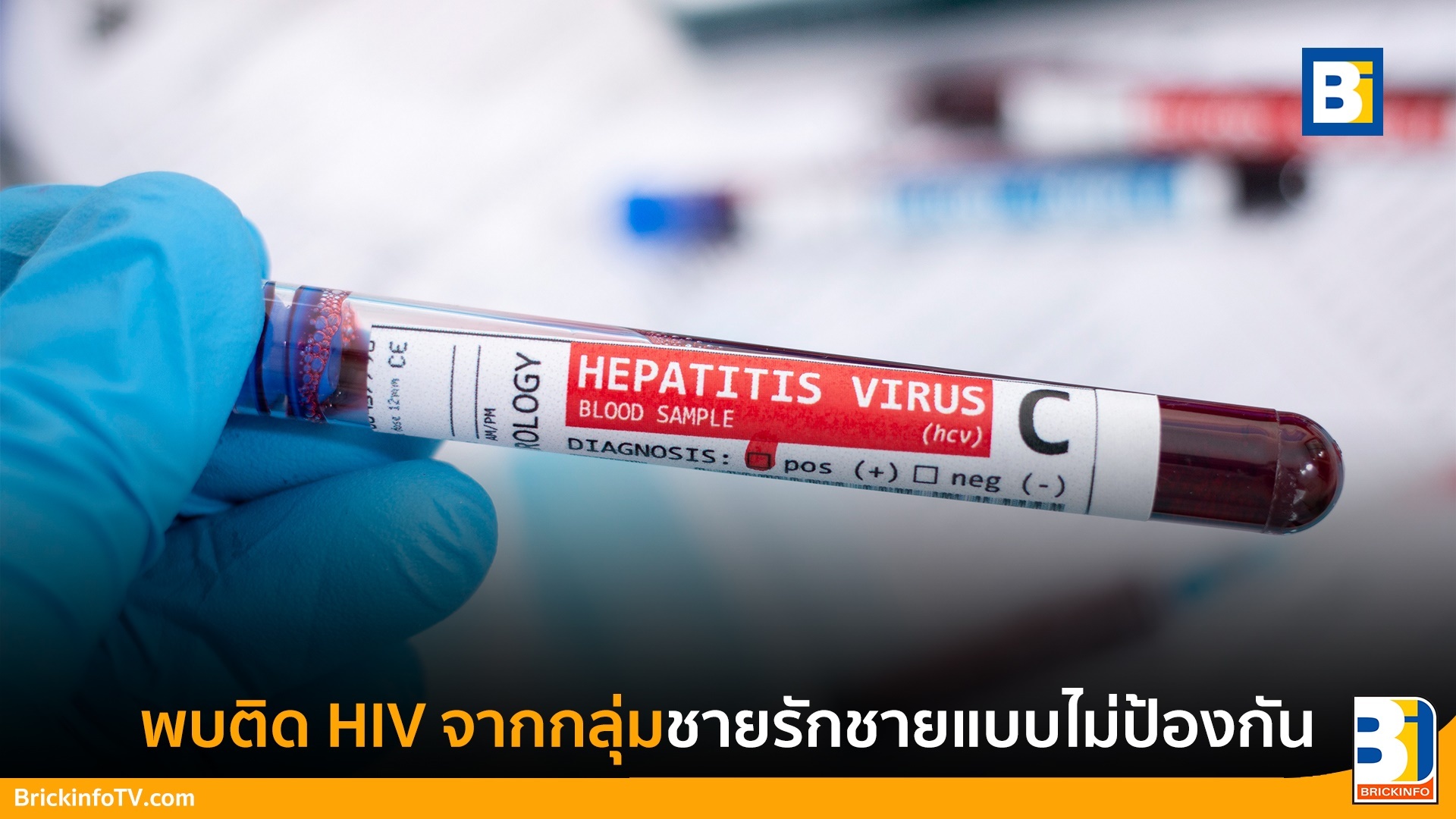 โรคเอดส์