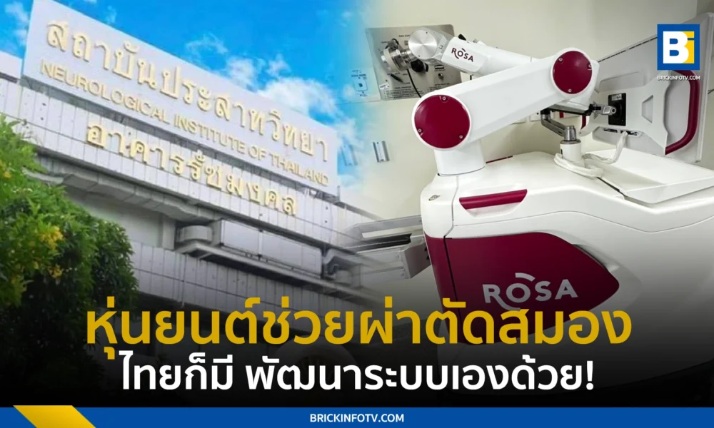 หุ่นยนต์ช่วยผ่าตัดสมอง