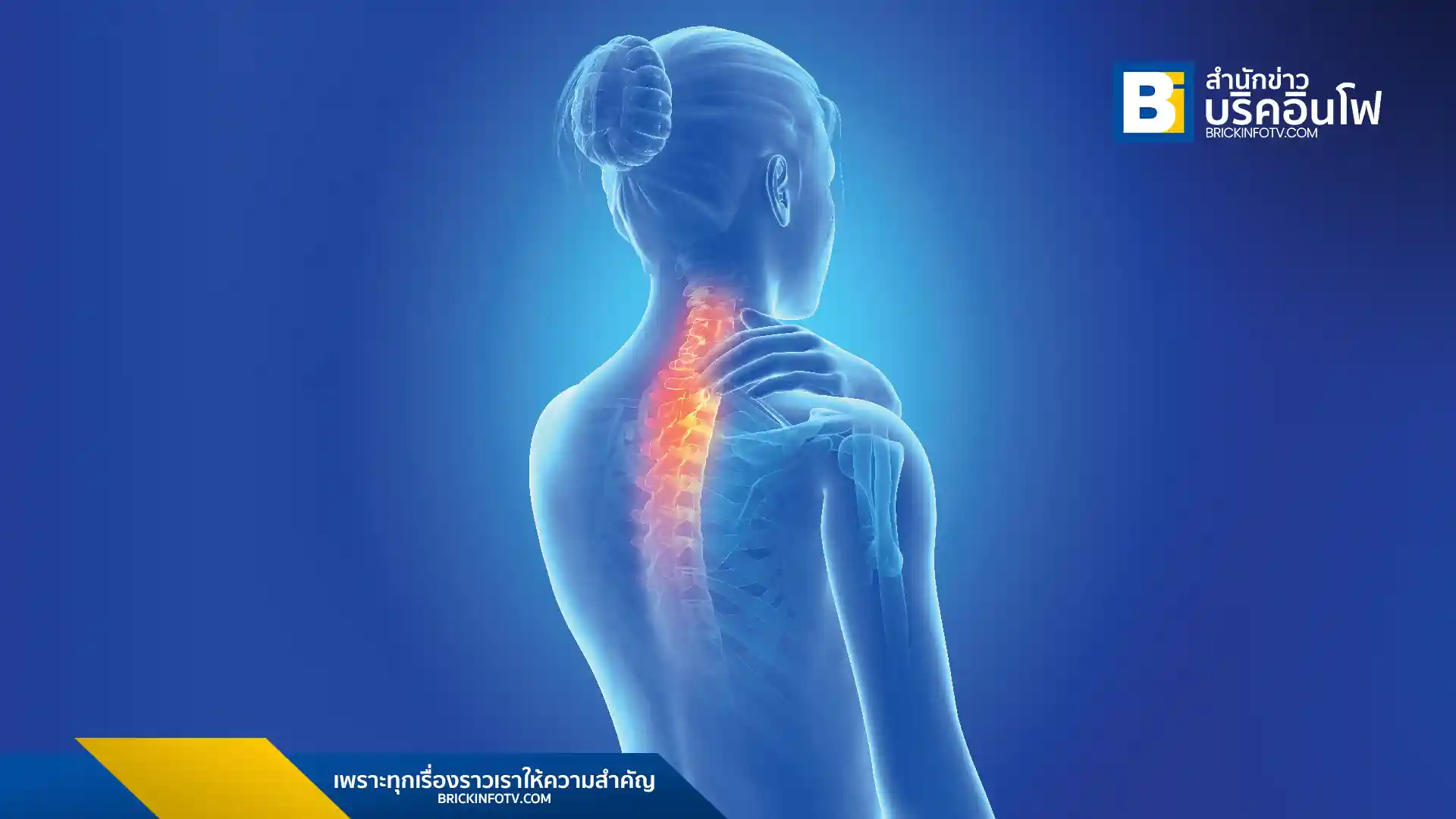 อาการปวดหัวที่มาพร้อมกับปวดคออาจเป็นสัญญาณเตือนของโรคกระดูกสันหลังที่ซ่อนอยู่ นพ.พร นริศชาติ แพทย์เฉพาะทางกระดูกสันหลัง โรงพยาบาลเอส สไปน์ ให้ข้อมูลเกี่ยวกับสาเหตุและแนวทางการดูแลเบื้องต้น