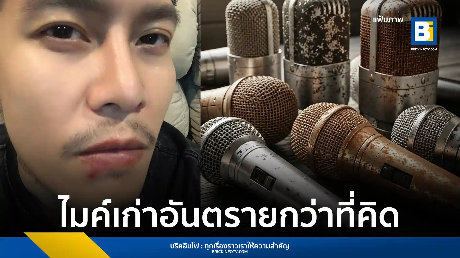 ดิว ภัทรพล หรือ ดิว เดอะสตาร์ 4 โพสต์เตือนภัยการใช้ไมโครโฟนสาธารณะ หลังติดเชื้อจนต่อมน้ำเหลืองอักเสบ พร้อมแนะนำวิธีป้องกันตัวสำหรับนักร้องและพิธีกร