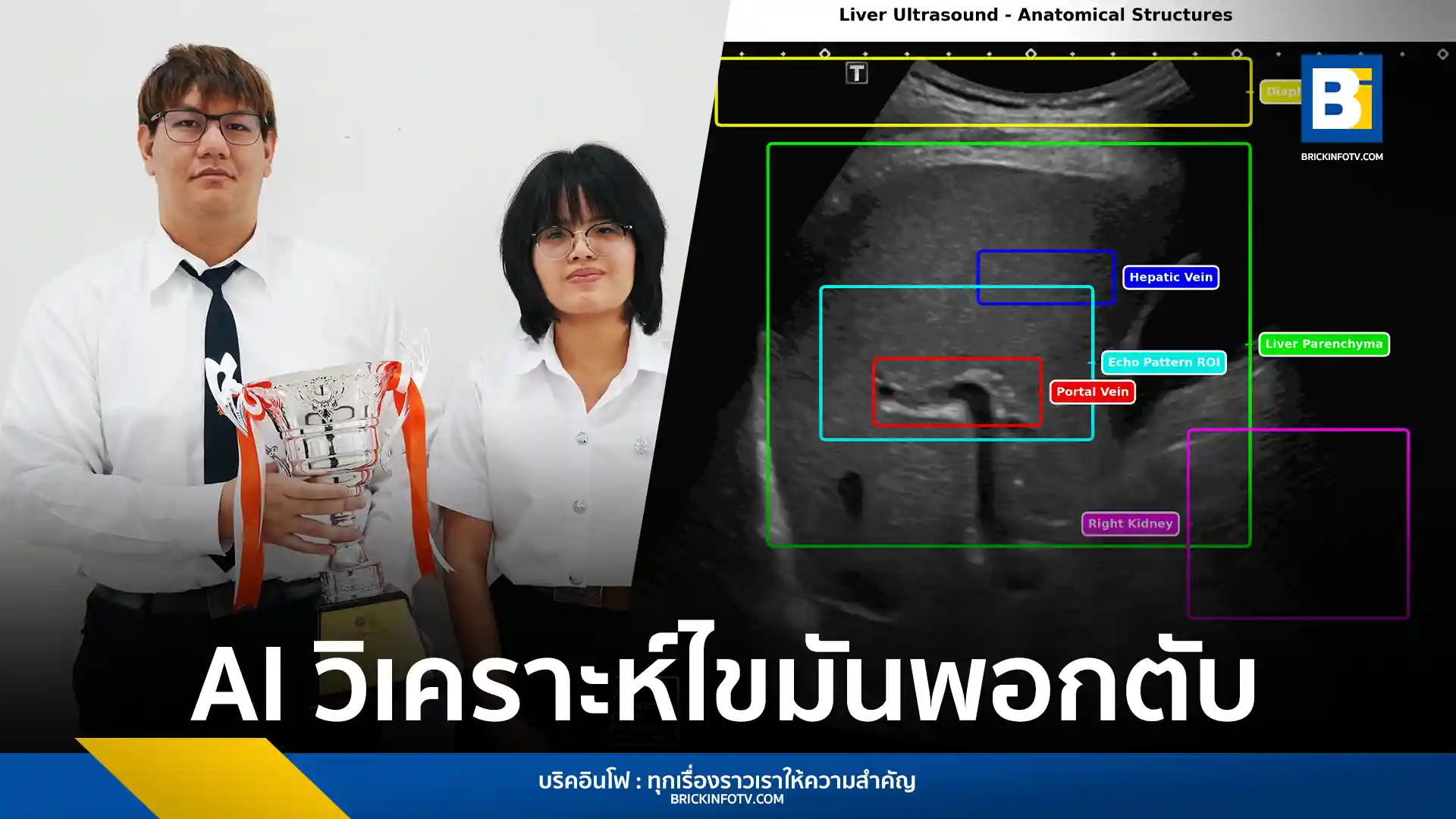 นักศึกษา มจธ. พัฒนา SmartLiva ระบบ AI วิเคราะห์ภาพอัลตราซาวด์ตรวจมะเร็งตับและพังผืด รู้ผลแม่นยำใน 7 วินาที ช่วยลดค่าตรวจเหลือเพียงหลักร้อยบาท