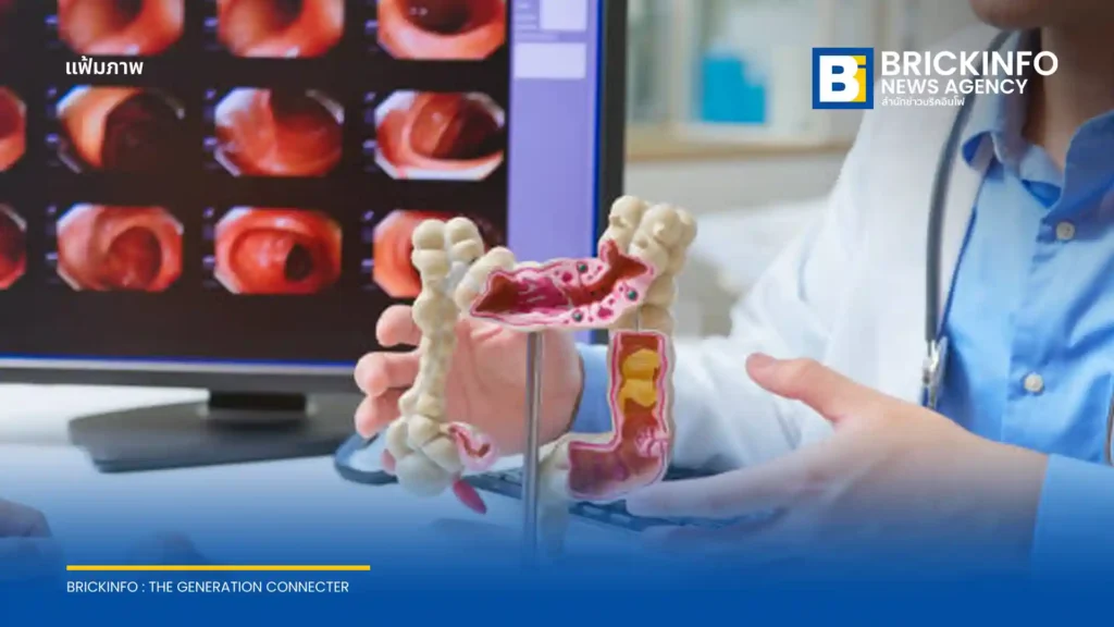เจาะนวัตกรรมศูนย์ทางเดินอาหารและตับ ชูเทคโนโลยี AI ส่องกล้อง และ Fibroscan ตรวจคัดกรองมะเร็งลำไส้และมะเร็งตับตั้งแต่ระยะเริ่มต้น เพื่อการรักษาที่แม่นยำ