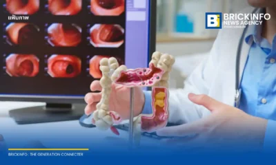 เจาะนวัตกรรมศูนย์ทางเดินอาหารและตับ ชูเทคโนโลยี AI ส่องกล้อง และ Fibroscan ตรวจคัดกรองมะเร็งลำไส้และมะเร็งตับตั้งแต่ระยะเริ่มต้น เพื่อการรักษาที่แม่นยำ