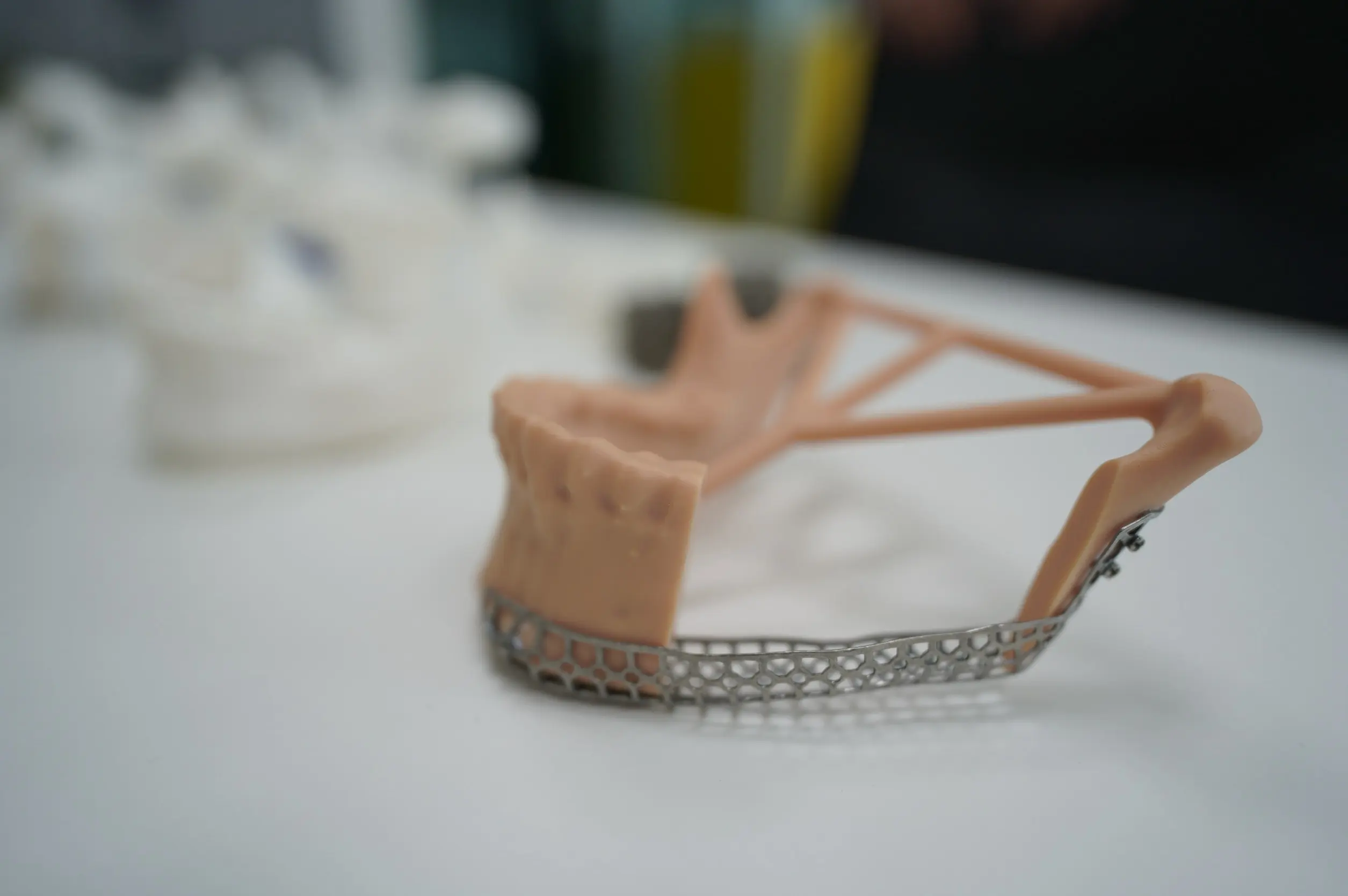 มจธ. ร่วมมือ 3 โรงพยาบาลพัฒนาแพลตฟอร์ม Osscentric ใช้ AI และ 3D Printing ออกแบบอุปกรณ์การแพทย์เฉพาะบุคคล ลดค่านำเข้าและเพิ่มความแม่นยำในการผ่าตัด