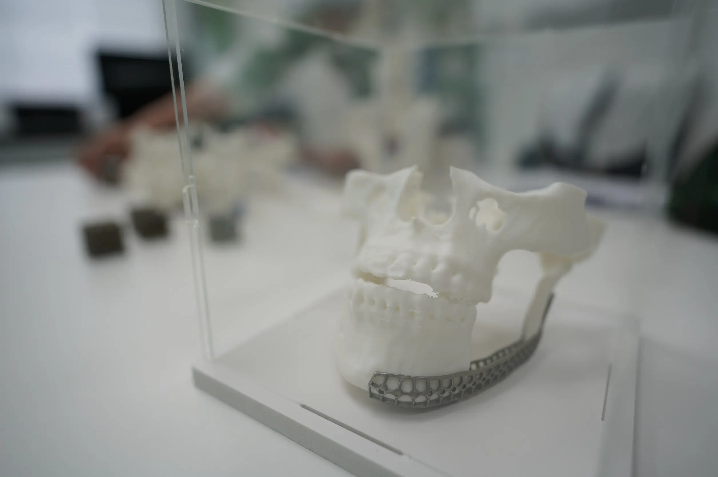 มจธ. ร่วมมือ 3 โรงพยาบาลพัฒนาแพลตฟอร์ม Osscentric ใช้ AI และ 3D Printing ออกแบบอุปกรณ์การแพทย์เฉพาะบุคคล ลดค่านำเข้าและเพิ่มความแม่นยำในการผ่าตัด