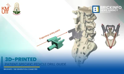มจธ. ร่วมมือ 3 โรงพยาบาลพัฒนาแพลตฟอร์ม Osscentric ใช้ AI และ 3D Printing ออกแบบอุปกรณ์การแพทย์เฉพาะบุคคล ลดค่านำเข้าและเพิ่มความแม่นยำในการผ่าตัด