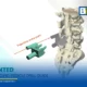 มจธ. ร่วมมือ 3 โรงพยาบาลพัฒนาแพลตฟอร์ม Osscentric ใช้ AI และ 3D Printing ออกแบบอุปกรณ์การแพทย์เฉพาะบุคคล ลดค่านำเข้าและเพิ่มความแม่นยำในการผ่าตัด